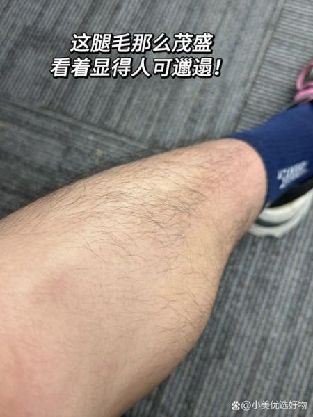 男生刮腿毛会影响财运吗_男生腿毛越刮越旺是真的吗