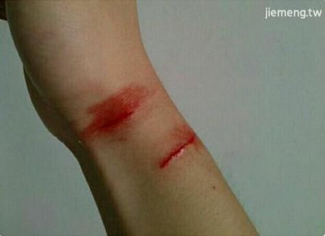 梦见被炸是什么意思_梦见爆炸自己受伤预示什么