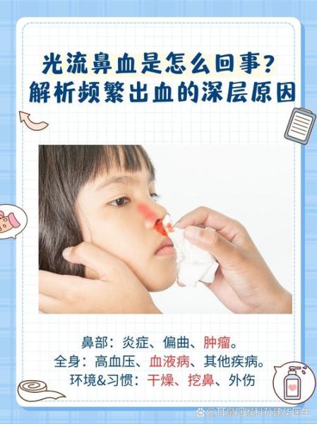 梦见自己流鼻血是什么意思_为什么会突然流鼻血