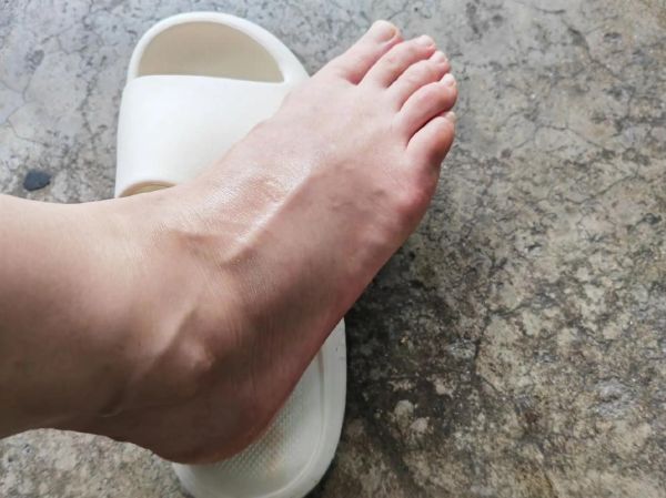 梦到脚肿大_梦见脚肿了代表什么