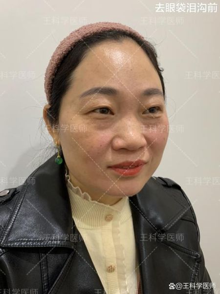 眼袋影响财运吗_眼袋与财运的关系