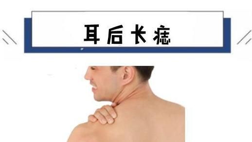 推车掉耳财运_推车掉耳财运是真的吗