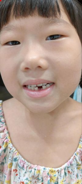 小孩梦到掉牙_怎么回事