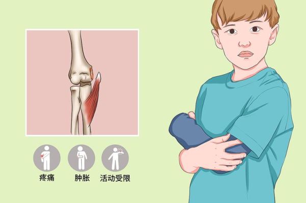 梦到亲人骨折是什么意思_梦见亲人骨折预示什么