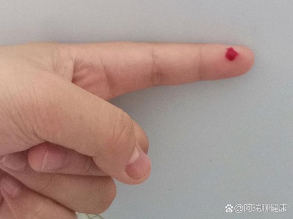 梦到手指流血是什么意思_如何化解