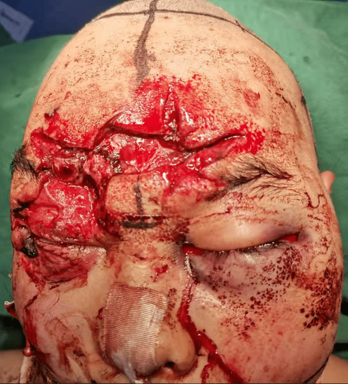 女儿梦到爸爸出车祸了_是什么意思