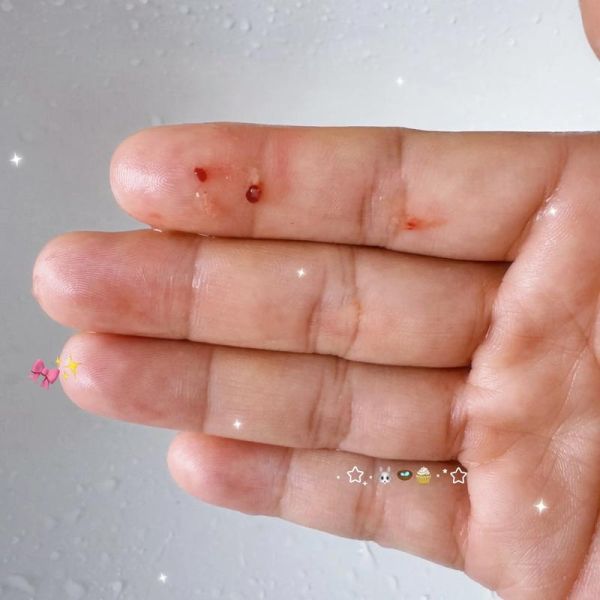 女人梦见鼻子出血_周公解梦准吗