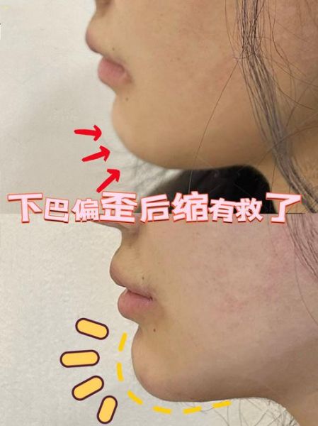 下巴歪会影响运势吗_下巴歪如何改运