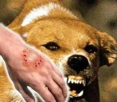 梦到被狗咬是什么意思_如何避免噩梦