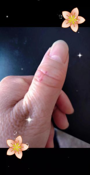 梦到划手是什么意思_梦见划手预示什么