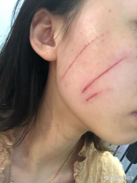 梦到被猫抓是什么意思_被猫抓伤预示什么