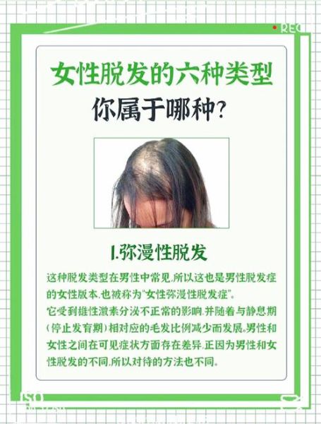 梦到洗头掉头发是什么意思_周公解梦洗头掉发