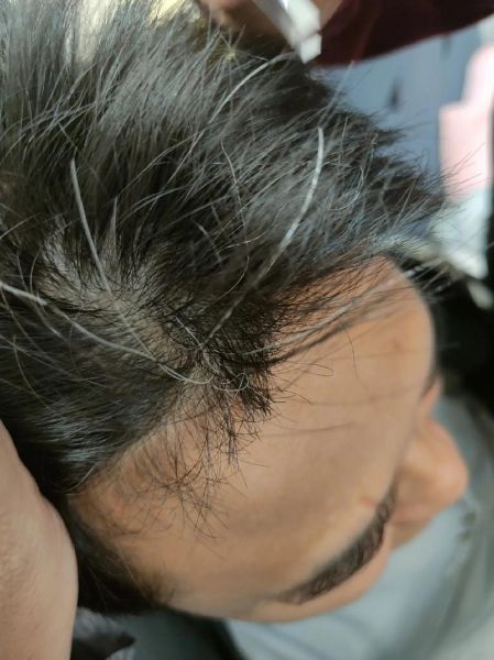 梦见拔白头发_是什么意思