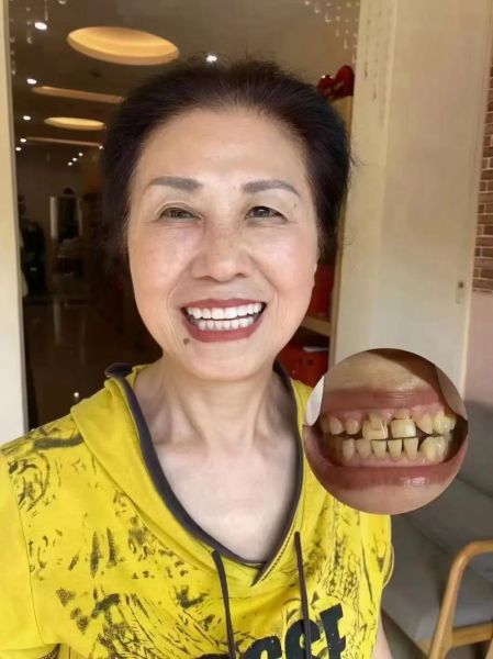 牙齿影响财运吗_牙齿漏财是真的吗