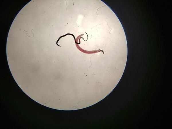 梦到吸血虫吸血_是什么意思