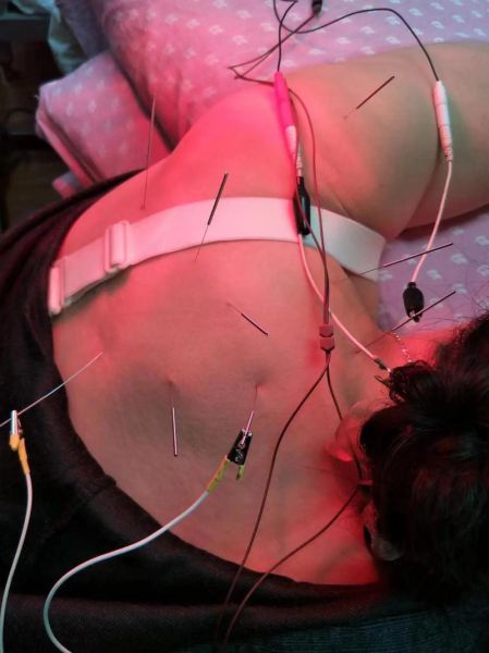 梦到身上扎了好多针_梦见全身被针扎是什么意思