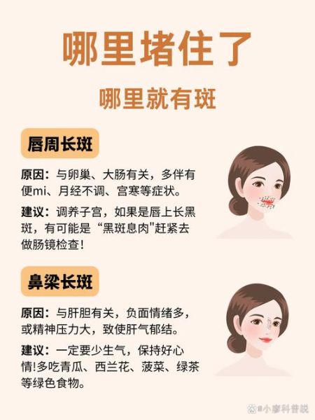 女人印堂长斑运势_如何化解印堂长斑带来的霉运