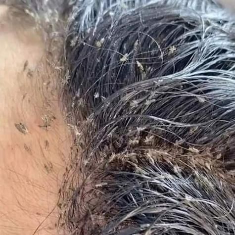 梦到女儿头上爬满虱子_是什么预兆